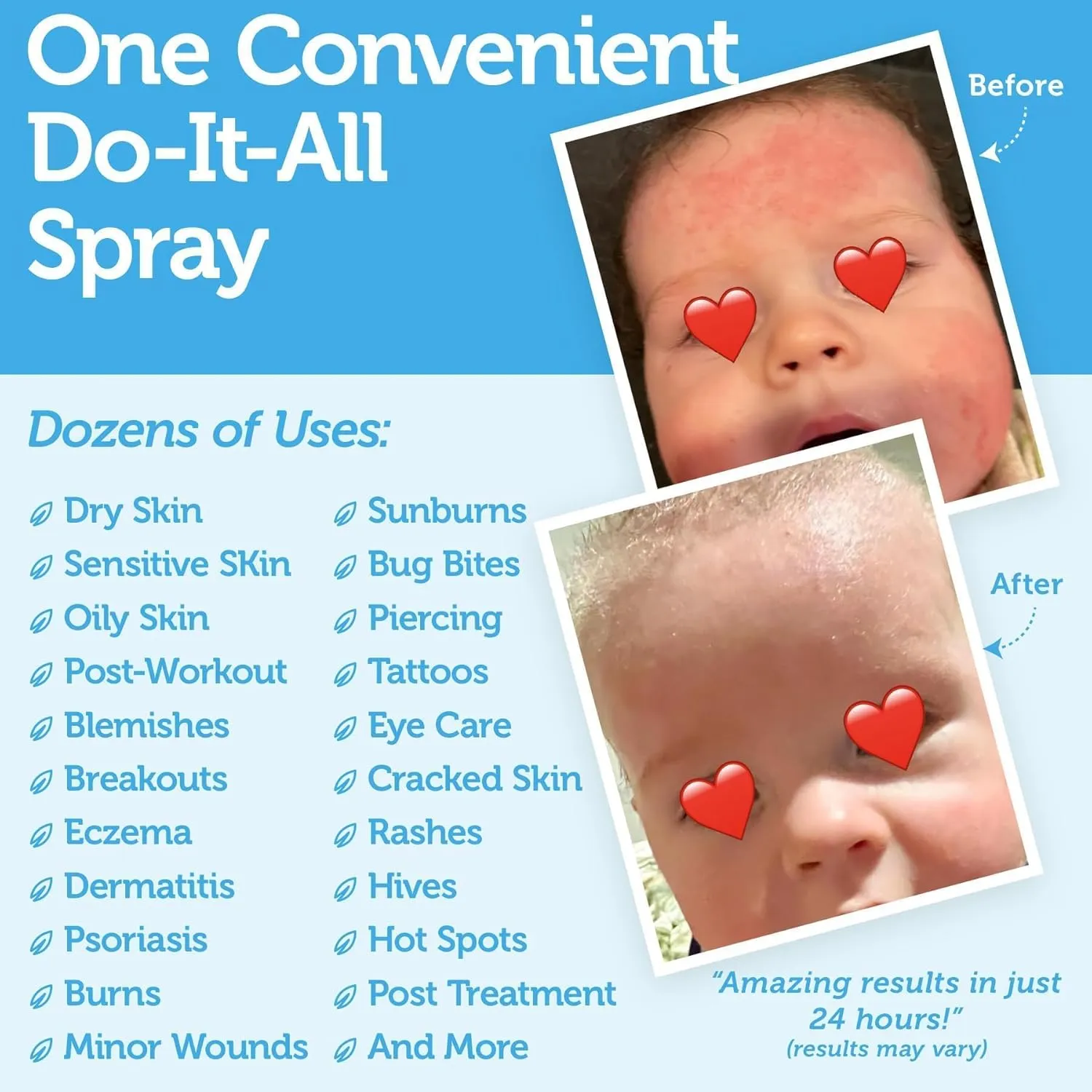 Happy Skin .02% Hypochlorous Acid Spray Toner Extra Strength, Extra Gentle 100% Natural Toner & Skin Cleanser for Face & Body Soothe, Hydrate & Repair Dry, Sensitive Skin pH Balanced, Non-Toxic 8oz